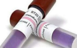 Sterilization Monitoring